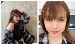 Thiều Bảo Trâm bất ngờ đăng ảnh mặt sưng vù, thừa nhận tiêm má?