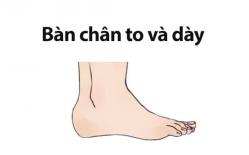 Tướng bàn chân phụ nữ đi trên nhung lụa cả đời hưởng phú quý