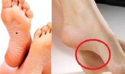 Tướng lòng bàn chân là 'hố chôn tiền', ai sở hữu được 3 đời giàu có