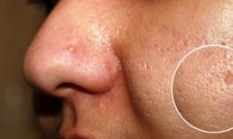 Những hành vi 'chết' của phụ nữ làm cho lỗ chân lông ngày càng to hơn!