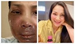 Hồng Ngọc khoe nhan sắc phục hồi nhanh thần tốc, đến Trấn Thành còn phải khen nức nở