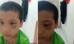 Vụ phụ huynh tát trẻ mẫu giáo: Người mẹ chính thức xin lỗi, công khai luôn ảnh đôi mắt bầm tím của con mình