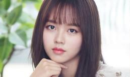 Sở hữu tướng cằm quý hơn kim cương, gia chủ làm gì cũng dễ dàng giàu có