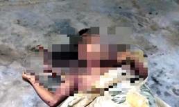 Điện thoại đang sạc phát nổ dính vào ngực, nam thanh niên tử vong