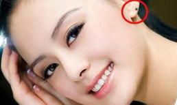 Nốt ruồi ở tai “hút lộc” gia chủ cả đời an nhàn, sau 30 tuổi trở thành tỷ phú