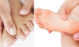 Những nốt ruồi ở chân chứa “mỏ vàng”, gia chủ cả đời giàu sang, sung túc, cuộc sống viên mãn ít ai sánh bằng