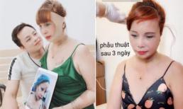 'Cô dâu 62 tuổi' ở Cao Bằng - Thu Sao lộ dung mạo sau 3 ngày phẫu thuật thẩm mỹ