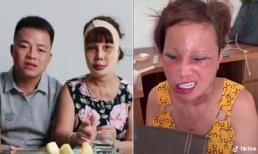 Thêm loạt ảnh gương mặt biến dạng sau dao kéo của 'cô dâu 62 tuổi' Thu Sao