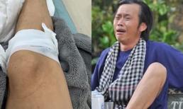 Danh hài Hoài Linh bị 'tai nạn' chảy máu chân, sa sẩm mặt mũi nhưng đối tượng 'gây án' lại cực bất ngờ