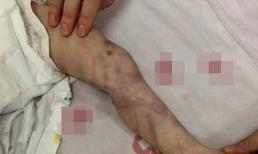 Bé 1 tuổi bị mẹ ruột đánh đến co giật và hôn mê 6 ngày, biết tuổi thật của mẹ khiến dân mạng 'sốc nặng'
