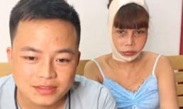 'Cô dâu 62 tuổi' Thu Sao méo miệng, sưng lệch mặt sau phẫu thuật thẩm mỹ