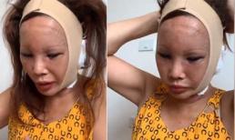 Tình hình sức khỏe của 'Cô dâu 62 tuổi' Thu Sao sau khi phải nhập viện cấp cứu lúc nửa đêm 