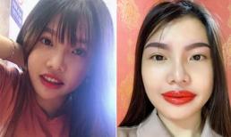 'Thị Nở tái sinh' Quách Phượng tiếp tục làm đẹp: Chân mày và bờ môi sưng tấy 