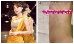 Hết Hari Won đến Tóc Tiên gặp tai nạn nghề nghiệp