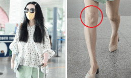 Phạm Băng Băng bị soi bàn chân gân guốc, đầu gối có sẹo khi diện chân váy ngắn 