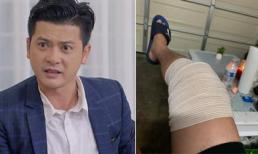 Tình hình sức khỏe hiện tại của diễn viên 'Gạo nếp gạo tẻ' Hoàng Anh sau ca mổ chân
