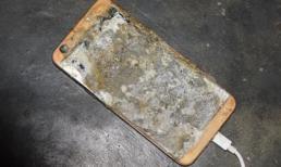 Nổ điện thoại khi vừa dùng vừa sạc pin, thanh niên bị cháy bỏng toàn thân