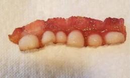 Cô gái khoe thành quả chiên thịt xông khói như phim kinh dị, vì ai cũng tưởng cả mảng lợi bị rớt