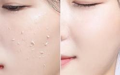 Làm trắng da phụ nữ cũng giống như phẫu thuật thẩm mỹ, đầu mùa thu 'thời kỳ vàng làm trắng', các phương pháp này giúp bạn tỏa sáng