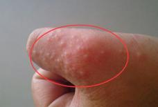 Cảnh giác! Những triệu chứng này có thể là dấu hiệu của bệnh ung thư! 