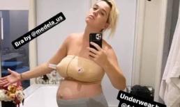 Nhìn thân hình sồ sề của Katy Perry sau 5 ngày sinh con, dân mạng hốt hoảng: 'Còn em bé nữa trong bụng à?'