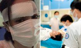 Chung Hân Đồng tiếp tục phẫu thuật sau khi bị chấn thương rách đầu phải khâu hàng chục mũi 