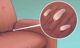 5 dấu hiệu cho thấy đã có bọ rệp giường trong nhà của bạn