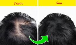 9 cách giúp tóc mọc dày tự nhiên và trị hói đầu hiệu quả