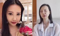 Sao nữ mắc ung thư khiến mặt biến dạng, cầu xin cộng đồng mạng giúp đỡ