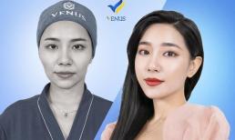 Tuyệt chiêu giảm cân không lo má tóp, hốc hác già nua