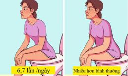 5 mối nguy hiểm bác sĩ cảnh báo với những người có mỡ bụng
