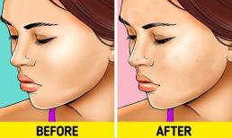 7 vấn đề sẽ xảy ra khiến làn da bị 'hủy hoại' nếu không tẩy trang trước khi ngủ