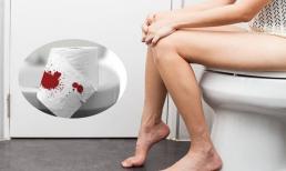 Phải làm gì nếu không thể đi đại tiện và ra nhiều máu sau khi sinh con?
