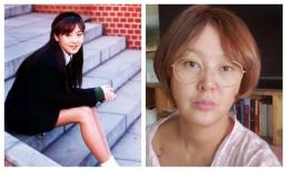 'Hiếu Kiêng' phim 'Mối tình đầu' xuống sắc không phanh ở tuổi 52 vì thẩm mĩ quá đà