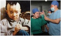 Trở nên nổi tiếng với cái tên 'Tam Mao', năm 14 tuổi nam diễn viên này phải khâu 300 mũi để mọc tóc, bây giờ anh không thể nhận ra diện mạo của mình