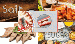 “Thủ phạm” gây nhồi máu não được tìm ra, chuyên gia khuyên: Đừng ăn 4 thực phẩm này, càng ăn càng tắc nghẽn mạch máu