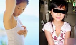 Con gái lớp 4 đi tắm, mẹ liếc nhìn và phát hiện điều bất thường khiến đêm về mất ngủ, phải đến gặp bác sĩ