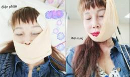 'Cô dâu 62 tuổi' bị biến chứng thẩm mỹ khiến mặt biến dạng! Vẫn kiên trì theo đuổi ước mơ làm đẹp 