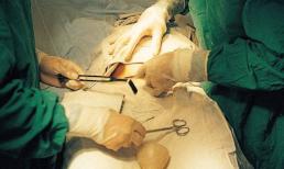 Biết đẻ mổ là để lại sẹo, vì sao nhiều sao nữ vẫn chọn cách sinh con này?