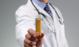 Đi tiểu màu vàng và có mùi hôi, cơ thể đang “gợi ý” một số bệnh cho bạn, đừng bỏ qua!