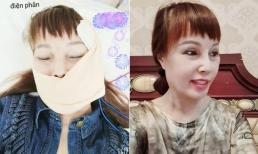 Nhan sắc mới nhất của 'cô dâu 62 tuổi' Thu Sao sau ca phẫu thuật khắc phục biến chứng lệch mặt 