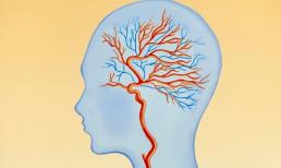 Ba triệu chứng, hãy coi chừng lượng máu cung cấp cho não không đủ