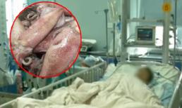 Cậu bé 11 tuổi có nguy cơ chạy thận suốt đời sau khi ăn bữa cơm chị gái nấu, 'thủ phạm' chính là một món ngon được bảo quản sai cách