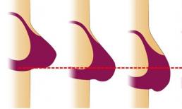 9 đồ vật thường dùng ảnh hưởng trực tiếp đến tuổi trẻ và nhan sắc của bất kỳ phụ nữ nào