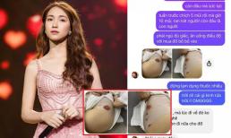 Hòa Minzy kiệt sức sau chuyến cứu trợ miền Trung, phải tiêm liên tục đến tứa máu để đủ sức quay hình