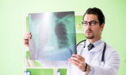 Thực tế phũ phàng: Nếu bố mẹ mắc những bệnh này thì rất có thể sẽ di truyền cho thế hệ sau