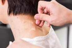 Có ung thư trong cơ thể sẽ có tín hiệu? Trên cổ có 3 “thứ” này, có thể ngụ ý rằng các tế bào ung thư đang ''xâm lấn”