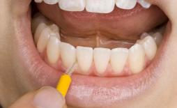 Phụ nữ đoản mệnh thường có 4 “trạng thái xấu xí” trên cơ thể, nếu chiếm trên 2 thì sự lão hóa đã bắt đầu