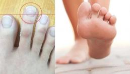 Tướng chân đàn ông số hưởng, cả đời sung sướng, sau 30 tuổi chắc chắn thành đạt