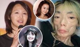 Hai mỹ nhân Hoa ngữ tự hủy hoại nhan sắc vì tình